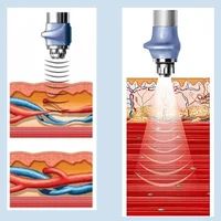Лечение без операции